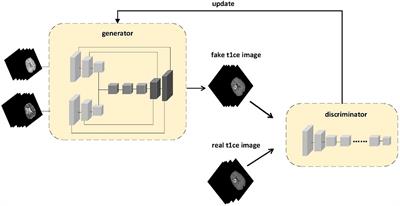 Multi-sequence generative adversarial network: better generation for enhanced magnetic resonance imaging images